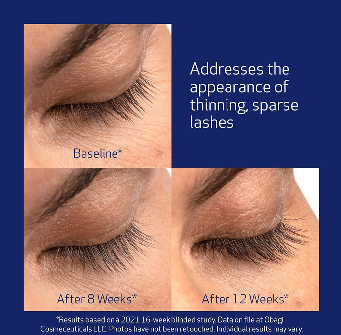 Before and After – Obagi Nu-Cil Eyelash Serum results at 8 and 12 weeks